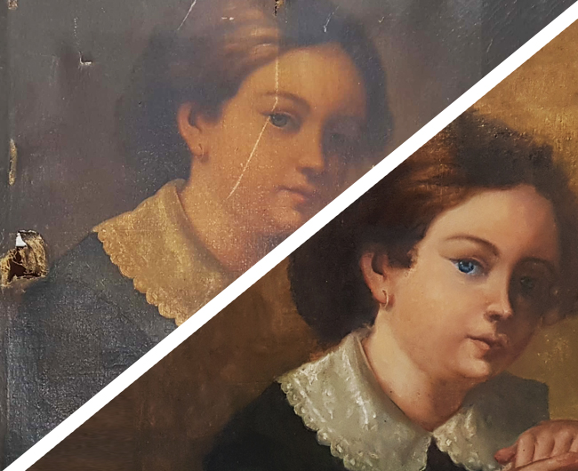 Suturas, reentelamento e remoção de repintura.